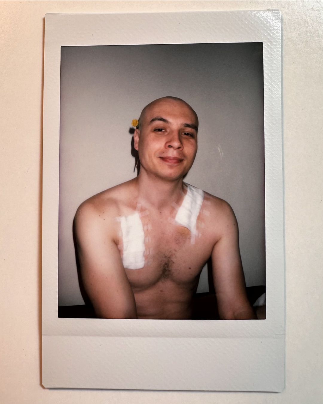 Зірка &quot;Голосу країни&quot; повідомив, що у нього рак